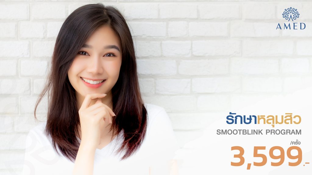 smootblink-รักษาหลุมสิว
